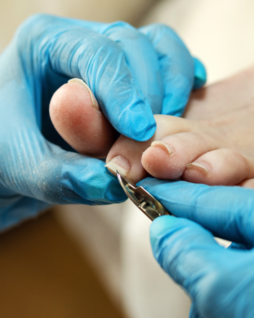Gloved podiatrist trimming a patient’s toenail